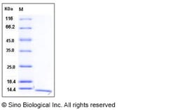 Sino Biological Recombinant Human S100A16 Protein, Quantity: Each of 1