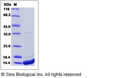 Sino Biological Recombinant Human S100A8 Protein (His Tag), Quantity: Each