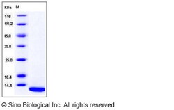 Sino Biological Human S100A7 / PSOR1 Protein 50ug, Quantity: Each of 1