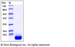 Sino Biological Human S100A10 Protein (His Tag) 100ug, Quantity: Each of