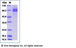 Sino Biological Recombinant Human Galectin-9/LGALS9 Protein (hFc Tag),