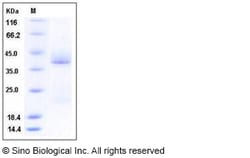 Sino Biological Recombinant Human CD69 Protein (His Tag), Quantity: Each