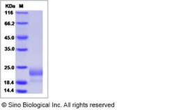 Sino Biological Recombinant Human CTLA-4 Protein, HPLC-verified, Quantity: