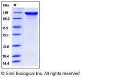 Sino Biological Recombinant Human Neuroligin 3/NLGN3 Protein (His Tag),