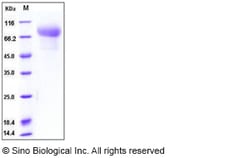 Sino Biological Recombinant Human CADM1 Protein (His Tag), HPLC-verified,