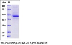 Sino Biological Human FAM19A2 Protein (Fc Tag) 100ug, Quantity: Each of