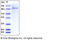 Sino Biological Human PLTP Protein (His Tag) 50ug, Quantity: Each of 1