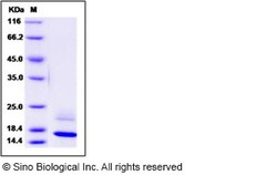 Sino Biological Recombinant Human REG4 Protein (His Tag), HPLC-verified,