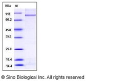 Sino Biological Recombinant Human PARP3 Protein (His & GST Tag), Quantity: