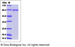Sino Biological Human ABL1 / JTK7 / p150 Protein (GST Tag) 50ug, Quantity: