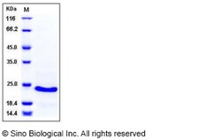 Sino Biological Recombinant Human CSRP1 Protein (His Tag), Quantity: Each