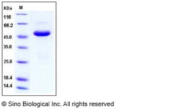 Sino Biological Human SETD7 / SET7/9 Protein (His Tag) 100ug, Quantity: