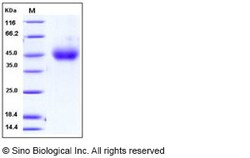 Sino Biological Influenza A H7N7 (A/chicken/Netherlands/1/03) Hemagglutinin