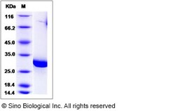 Sino Biological Schistosoma japonicum Glutathione S-transferase / GST Protein