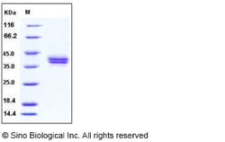 Sino Biological Human CADM3 / NECL1 / IGSF4B Protein (His Tag) 100ug, Quantity: