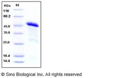 Sino Biological Recombinant Human RIZ1 Protein (GST Tag), Quantity: Each