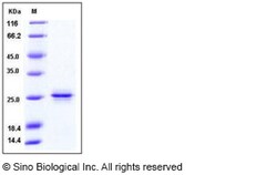 Sino Biological Human PRDM2 / RIZ1 Protein 100ug, Quantity: Each of 1