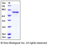 Sino Biological Recombinant Human SMYD3 Protein (GST Tag), Quantity: Each