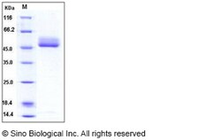 Sino Biological Human B4GALT1 / GGTB2 Protein (His Tag) 20ug, Quantity: