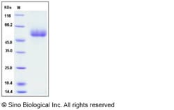 Sino Biological Recombinant Human Apolipoprotein H Protein (His Tag), HPLC-verified,