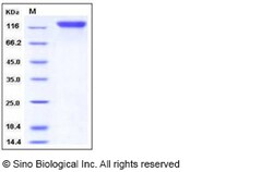 Sino Biological Recombinant Human OSMR Protein (His Tag), HPLC-verified,