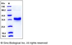 Sino Biological Recombinant Human FOLR1 Protein (ECD, His Tag), HPLC-verified,