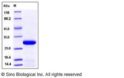 Sino Biological Human PPM1G / PP2C-gamma Protein (aa 317-546, His Tag)