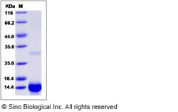 Sino Biological Human TGFA / TGF-alpha Protein 20ug, Quantity: Each of