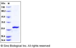 Sino Biological Human Peroxiredoxin 2 / PRDX2 Protein (His Tag) 100ug,