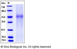 Sino Biological Recombinant Human TPST1 Protein (His Tag), Quantity: Each