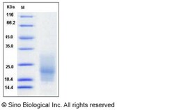 Sino Biological Recombinant Human CD63 Protein (His Tag), Quantity: Each