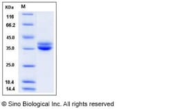 Sino Biological Recombinant Human GPA33/A33 Protein (His Tag), Quantity:
