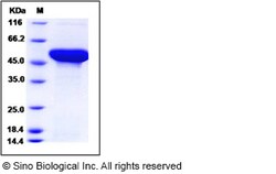 Sino Biological Human ADSL / Adenylosuccinate Lyase Protein (His Tag) 100ug,