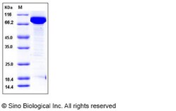 Sino Biological Recombinant Human EED Protein (His & GST Tag), Quantity: