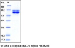Sino Biological Human FUT10 / Fucosyltransferase 10 Protein (His Tag) 100ug,