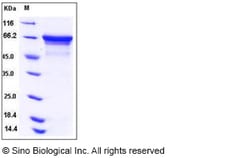Sino Biological Recombinant Human HSC70 Protein (His Tag), Quantity: Each