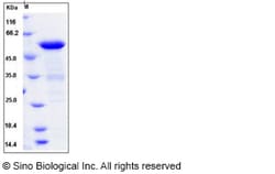 Sino Biological Human BIN1 / Amphiphysin-II Protein (His Tag) 100ug, Quantity:
