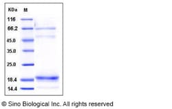 Sino Biological Human Cochlin / COCH Protein (His Tag) 100ug, Quantity:
