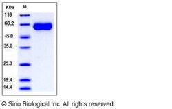 Sino Biological Human MGAT5 / GGNT5 Protein (His Tag) 50ug, Quantity: Each