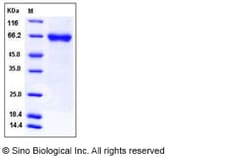 Sino Biological Recombinant Human LRRTM4 Protein (His Tag), Quantity: Each