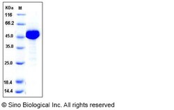 Sino Biological Human ALDH1 / ALDH1A1 / ALDC Protein (His Tag) 50ug, Quantity:
