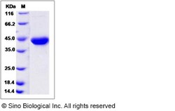 Sino Biological Recombinant Human Galanin Protein (hFc Tag), Quantity: