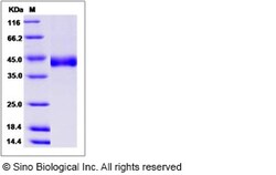 Sino Biological Recombinant Human CHST11 Protein (His Tag), Quantity: Each