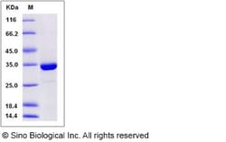 Sino Biological Human SULT1A3 Protein (His Tag) 50ug, Quantity: Each of