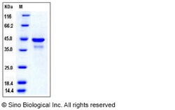 Sino Biological Recombinant Human SULT2B1 Protein (His Tag), Quantity: