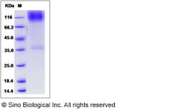 Sino Biological Human B3GNT2 Protein (Fc Tag) 50ug, Quantity: Each of 1