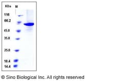 Sino Biological Recombinant Human Pyruvate kinase PKM Protein (Isoform