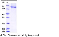 Sino Biological Human AGO3 / Argonaute 3 / EIF2C3 Protein (His Tag) 20ug,