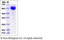 Sino Biological Human EphA3 Protein (His Tag) 100ug, Quantity: Each of