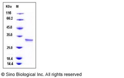 Sino Biological Recombinant Human CUTC Protein (His Tag), Quantity: Each